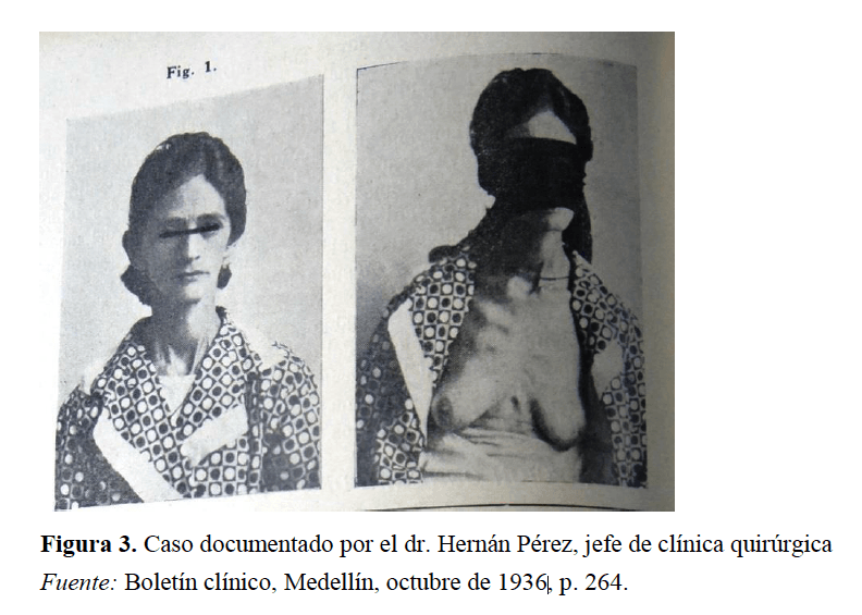 Intersex, Cazuela de fríjoles con el fin de medir los cuerpos verdaderamente paisas., El Poblado en Historias