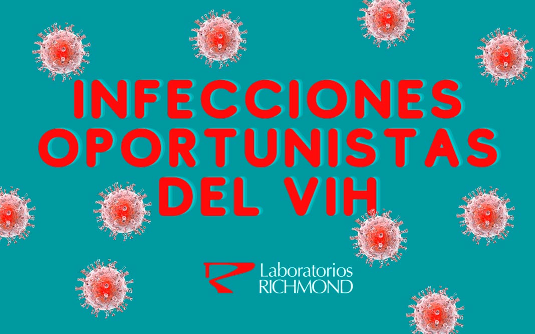 sobre-infecciones-oportunistas-vih-como-evitarlas VIH